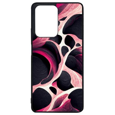 Gyönyörű fekete-fehér és pink márvány mintás Xiaomi 11T/11T Pro tok