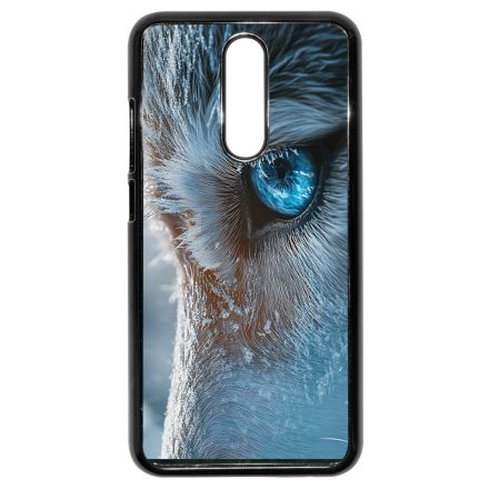 Hideg tekintet Xiaomi Redmi 8 tok